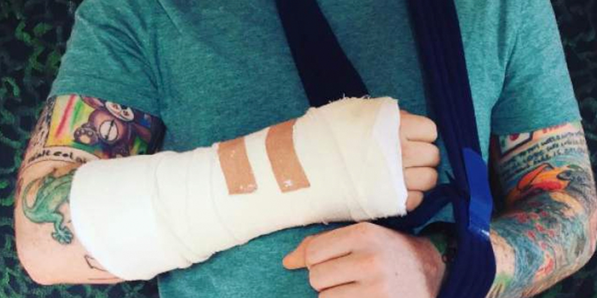 Ed Sheeran se fractura un brazo en accidente de bicicleta