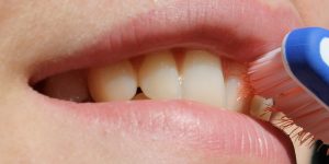 El cepillado diario, vacuna contra la caries dental