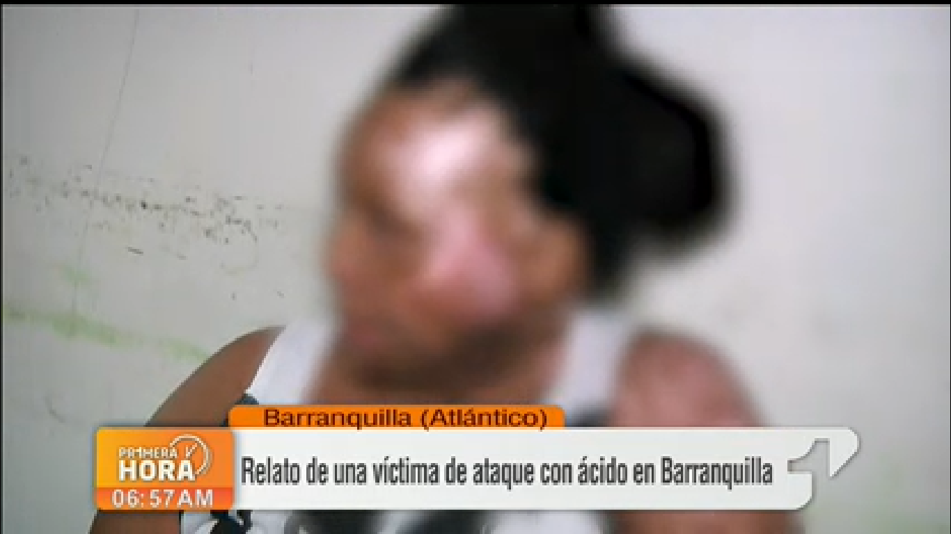 “Me quemó para que no fuera de nadie más”, mujer quemada con ácido