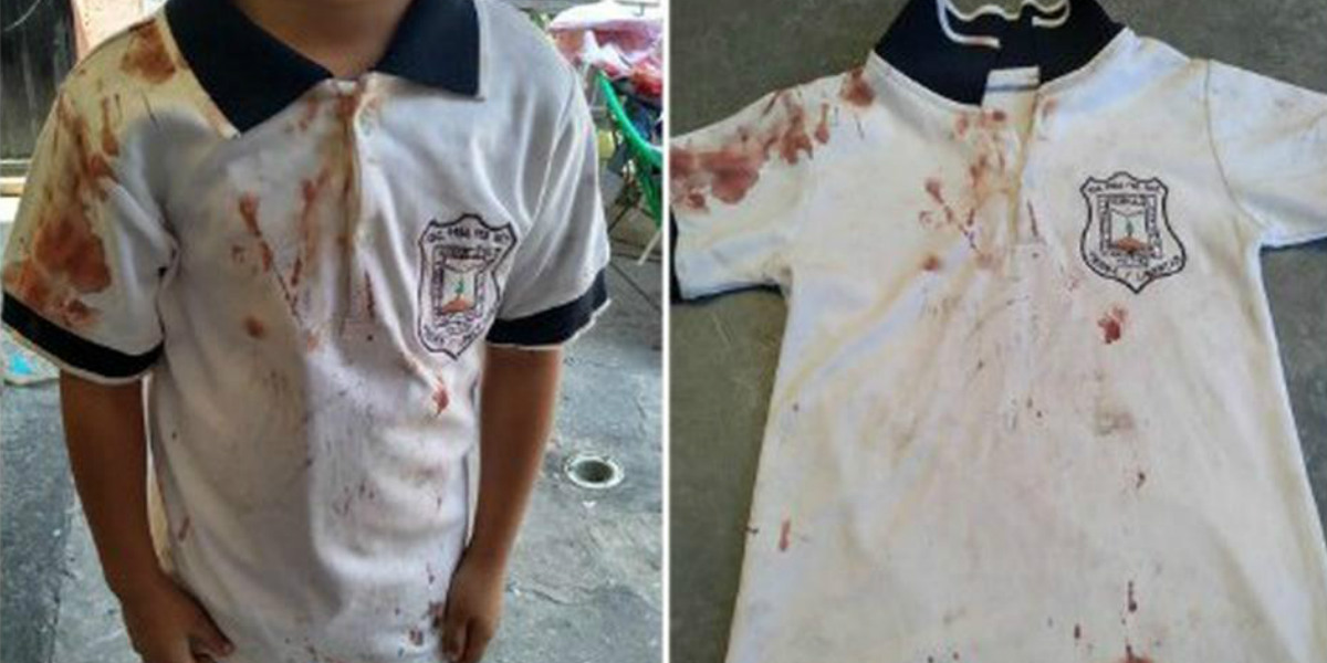 La golpiza a un niño fue tan dura, que mamá denuncia el bullying de su hijo con su camiseta ensangrentada