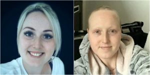¡Qué error! Le dijeron que no tenía cáncer luego de extirparle los senos y hacerle quimio