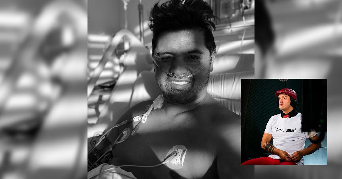 La impactante foto de Hassam completamente calvo en medio de su lucha contra el cáncer