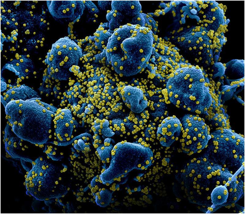 fotos coronavirus atacando celulas humanas niaid