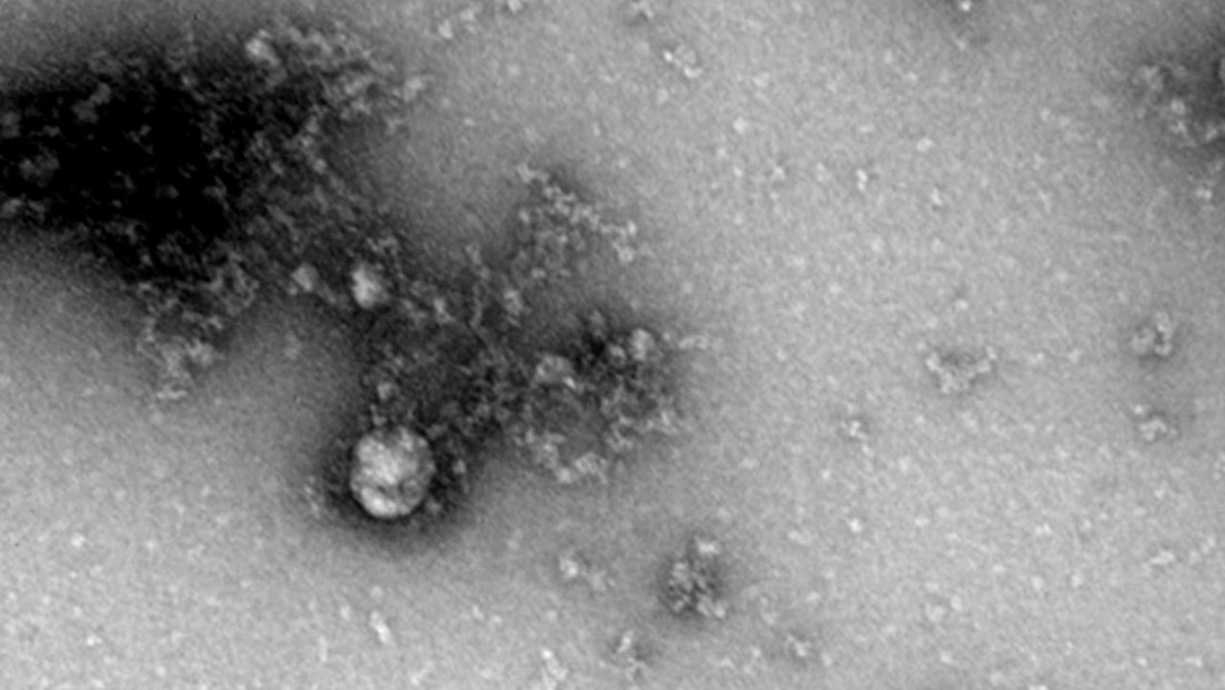 primera foto cepa británica coronavirus
