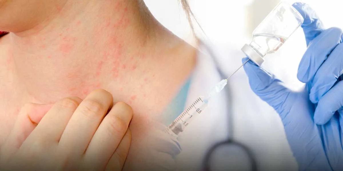 Qué es cierto y qué no: alergias y efectos adversos de la vacuna contra COVID-19
