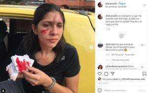 Diana Carreño, la joven de Bucaramanga que denunció brutal agresión