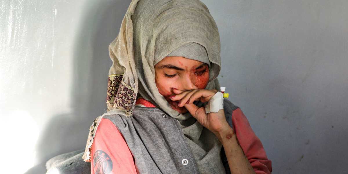 Al Anud Husein Sharian desfigurada ataque con acido yemen