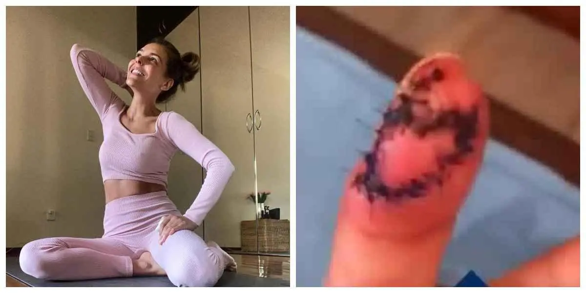 Famosa actriz adquirió un cáncer en un dedo debido a una ‘manicure’
