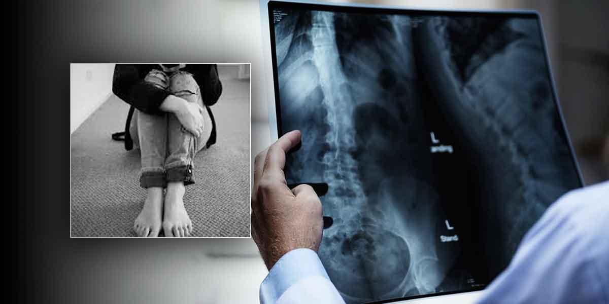 Radiólogo habría abusado de paciente durante toma de rayos X en Bogotá -  Noticentro 1 CM&