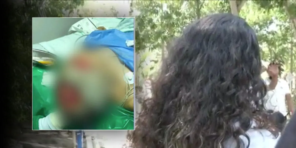 En Barranquilla, un hombre le arrancó el cuero cabelludo con un cuchillo a su pareja porque se negó a tener relaciones