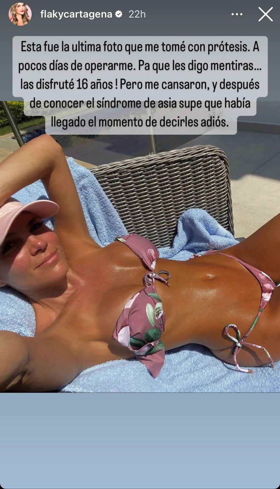 Mabel Cartagena con prótesis en los senos