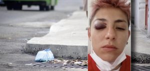 Joven denuncia que fue golpeada por pedir a un vecino que no botara basura a la calle en Bogotá