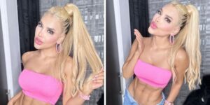 ¡Impactante! La Barbie colombiana, Tatiana Murillo, mostró su extracción de pómulos