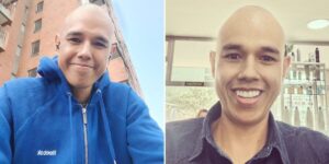 Diego Guauque reapareció y mostró su apariencia tras superar el cáncer