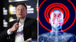 Elon Musk anuncia que logró la primera implantación de un chip en el cerebro humano