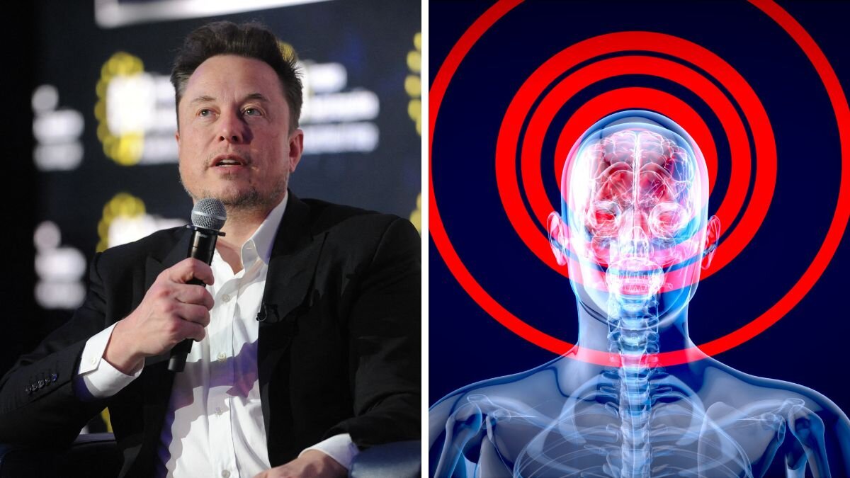 Elon Musk Anuncia Que Logró La Primera Implantación De Un Chip En El