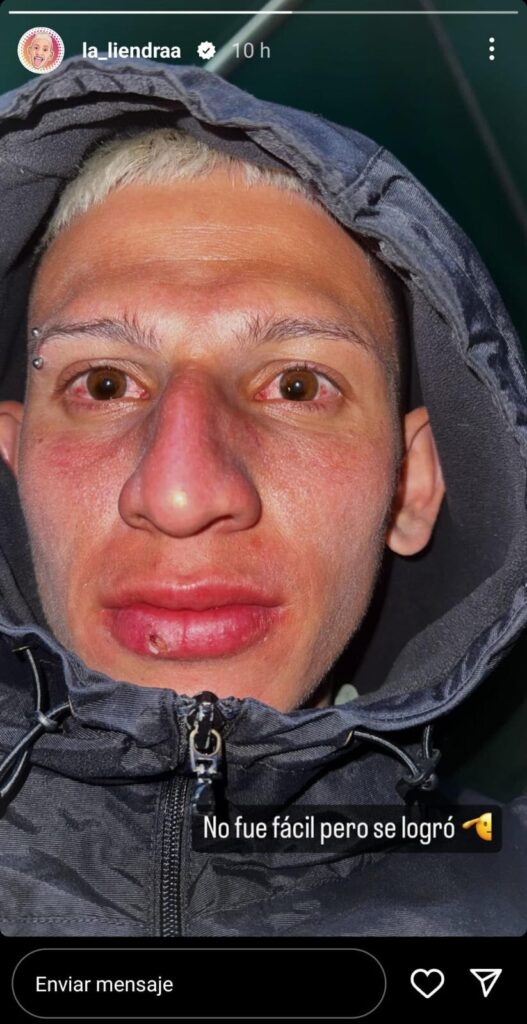Finalmente La Liendra apareció y no de la mejor forma: el influencer se ...