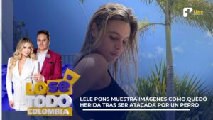 Lele Pons muestra en imágenes como quedó su herida tras ser atacada por un perro